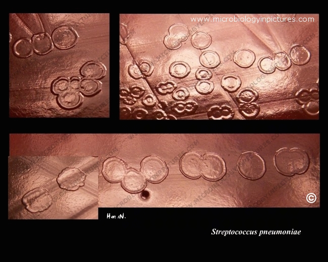 colony morphology of pneumococci, R form